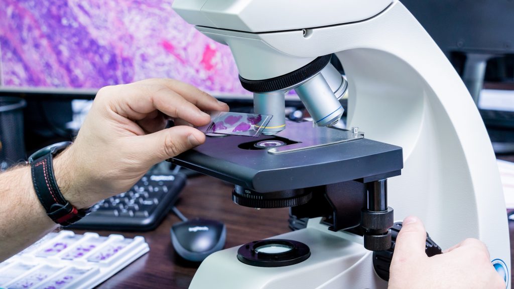 Challenges in Thymic Tumor Pathology